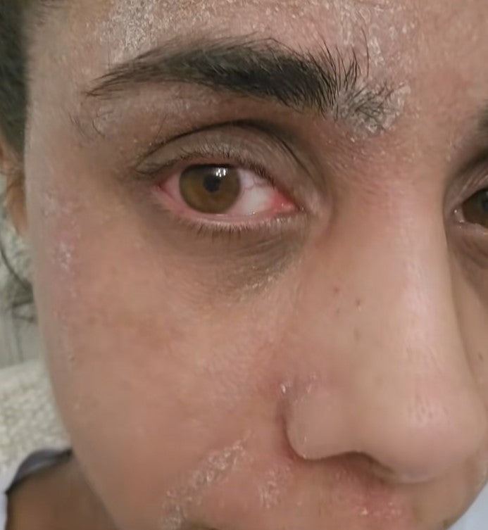 I struggled so much to look at the screen and even read!